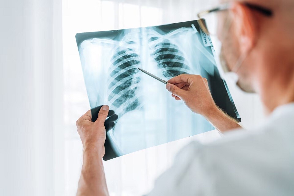 Pesquisa mostrou qeu 92,4% dos pacientes tinham algum tipo de comprometimento respiratório após se recuperar da doença | Foto: Soloviova Liudmyla/ Adobe Stock